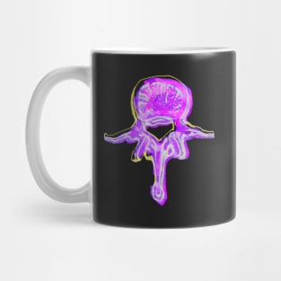 Lumbar Vertebrae 2 Mug